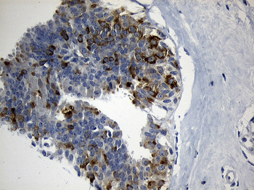 FBXO6 Antibody in Immunohistochemistry (Paraffin) (IHC (P))