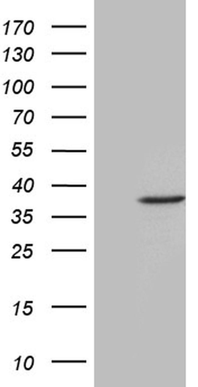 FBXO6 Antibody in Western Blot (WB)