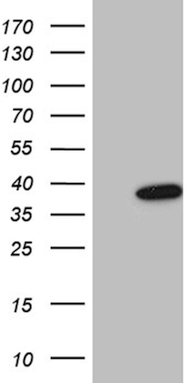 FBXO6 Antibody in Western Blot (WB)