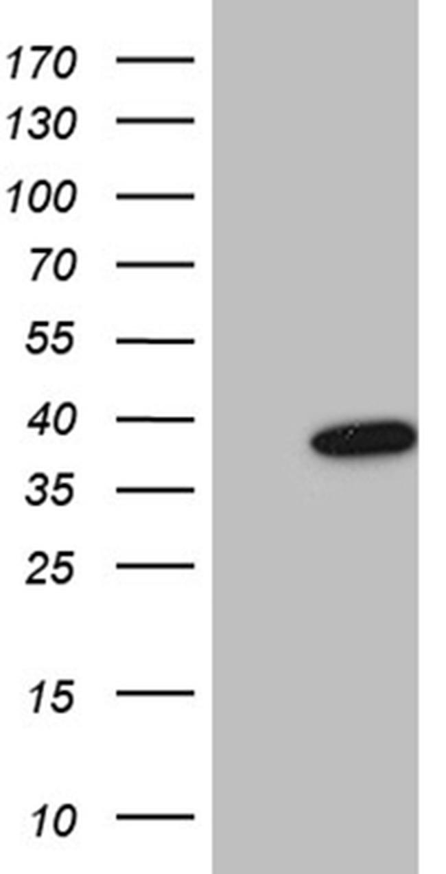 FBXO6 Antibody in Western Blot (WB)