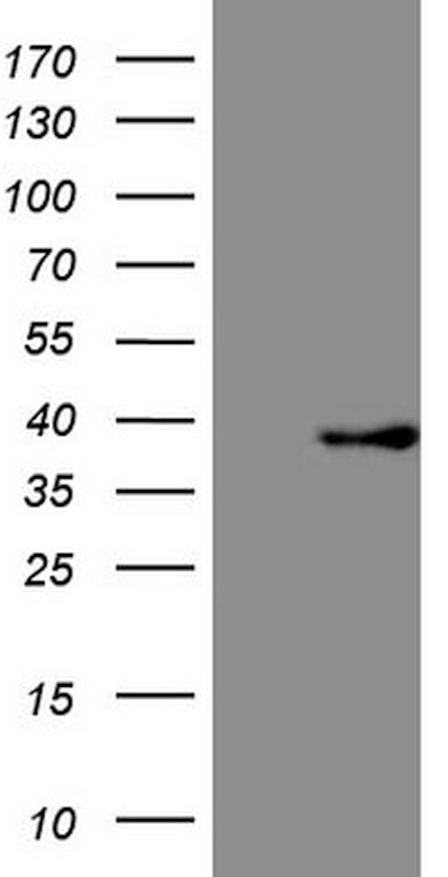 FBXO8 Antibody in Western Blot (WB)