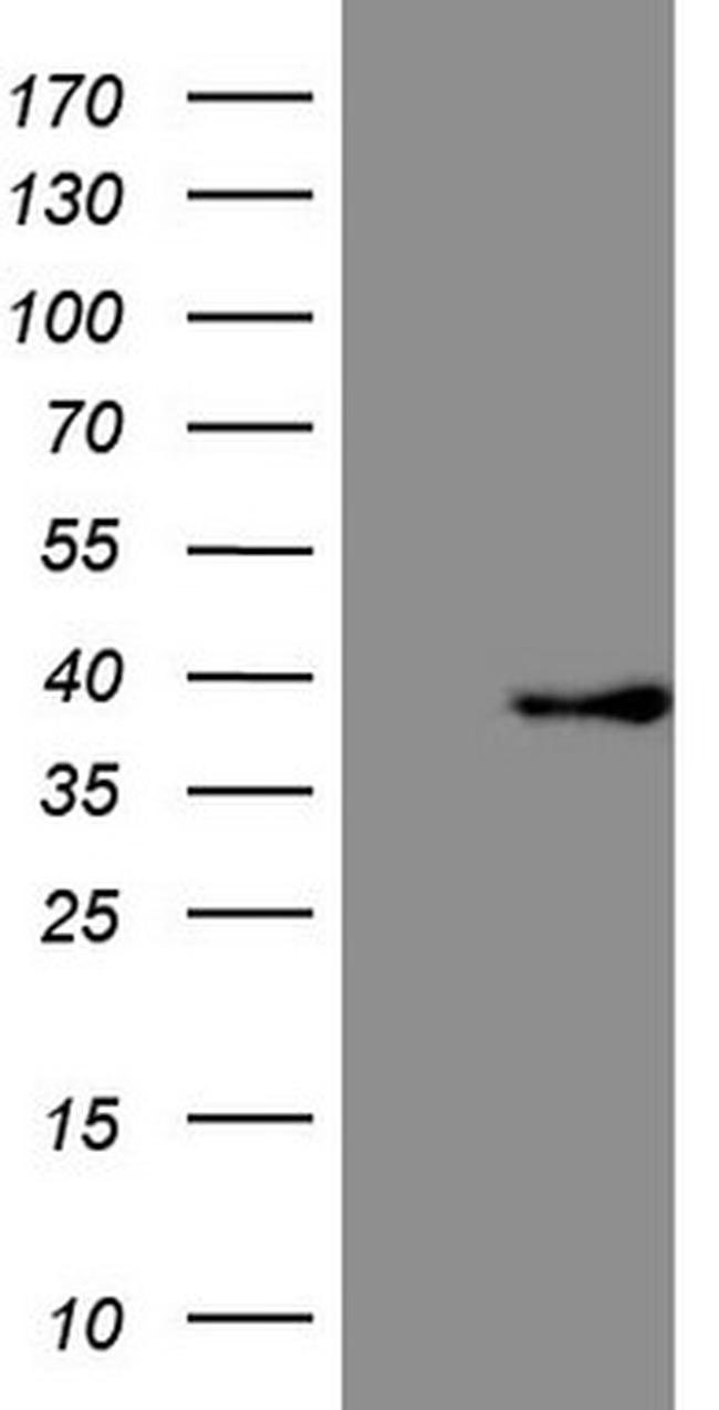 FBXO8 Antibody in Western Blot (WB)