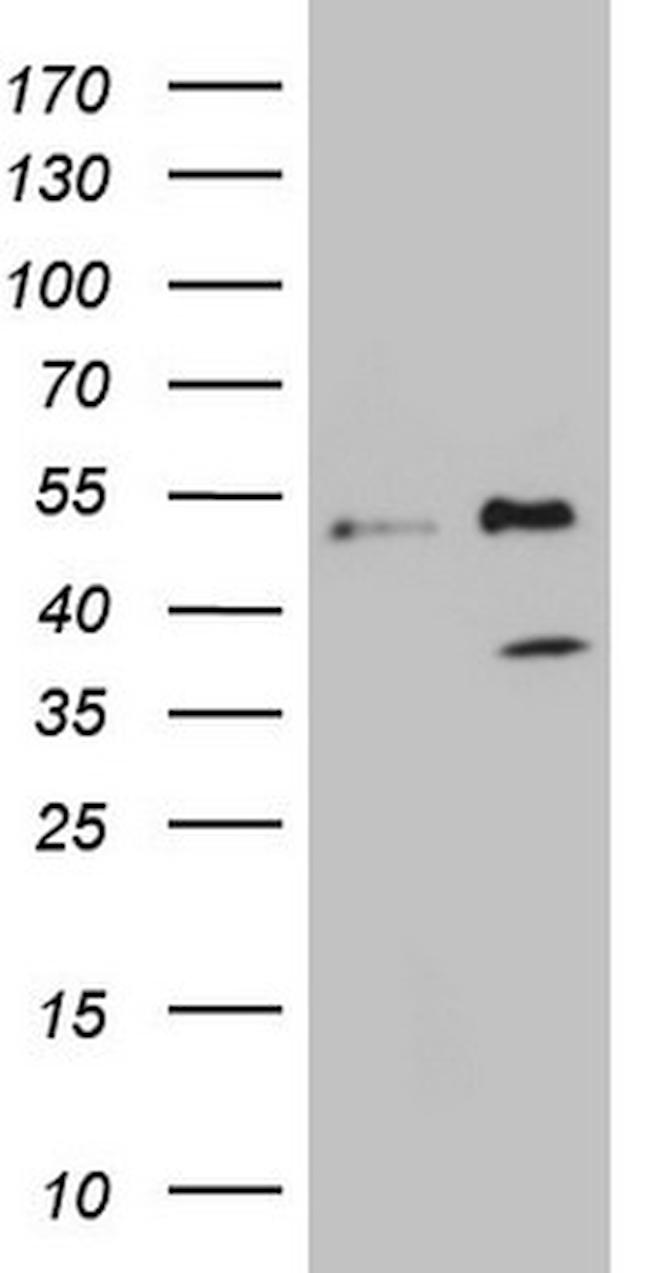 FBXO8 Antibody in Western Blot (WB)