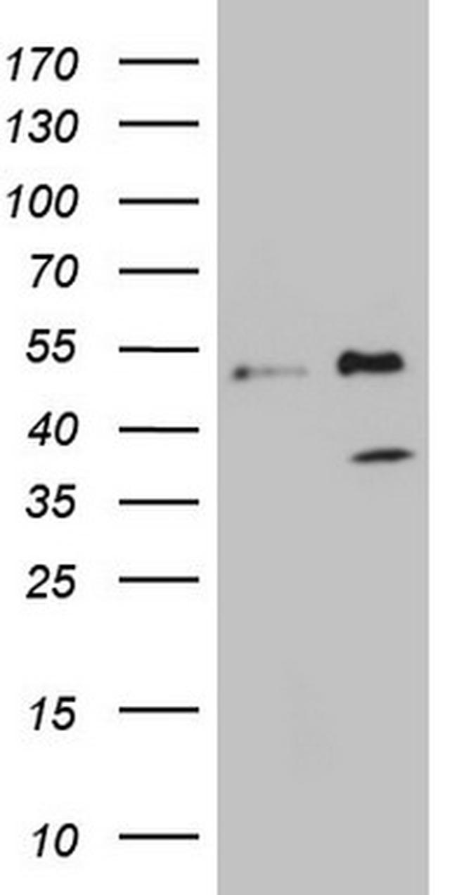 FBXO8 Antibody in Western Blot (WB)