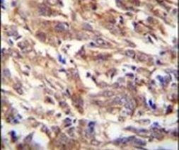 FBXW12 Antibody in Immunohistochemistry (IHC)