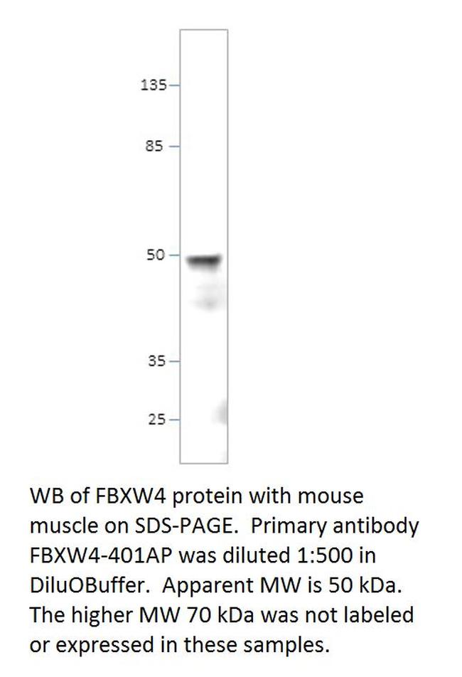 FBXW4/SHFM3 Antibody in Western Blot (WB)