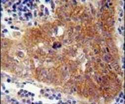 FBXW8 Antibody in Immunohistochemistry (IHC)