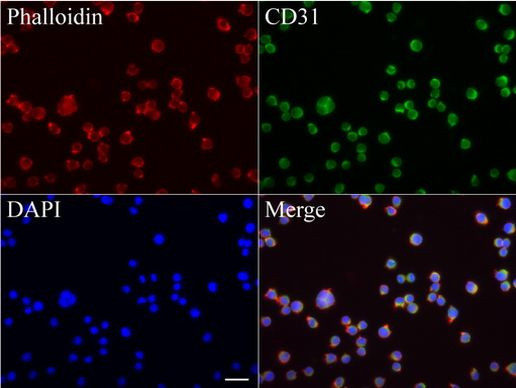 FCER2 Antibody in Immunocytochemistry (ICC/IF)
