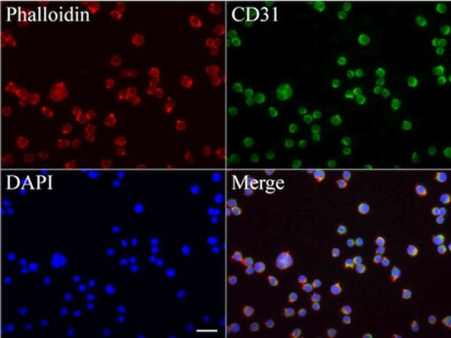 FCER2 Antibody in Immunocytochemistry (ICC/IF)