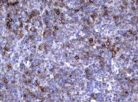 FCER2 Antibody in Immunohistochemistry (Paraffin) (IHC (P))