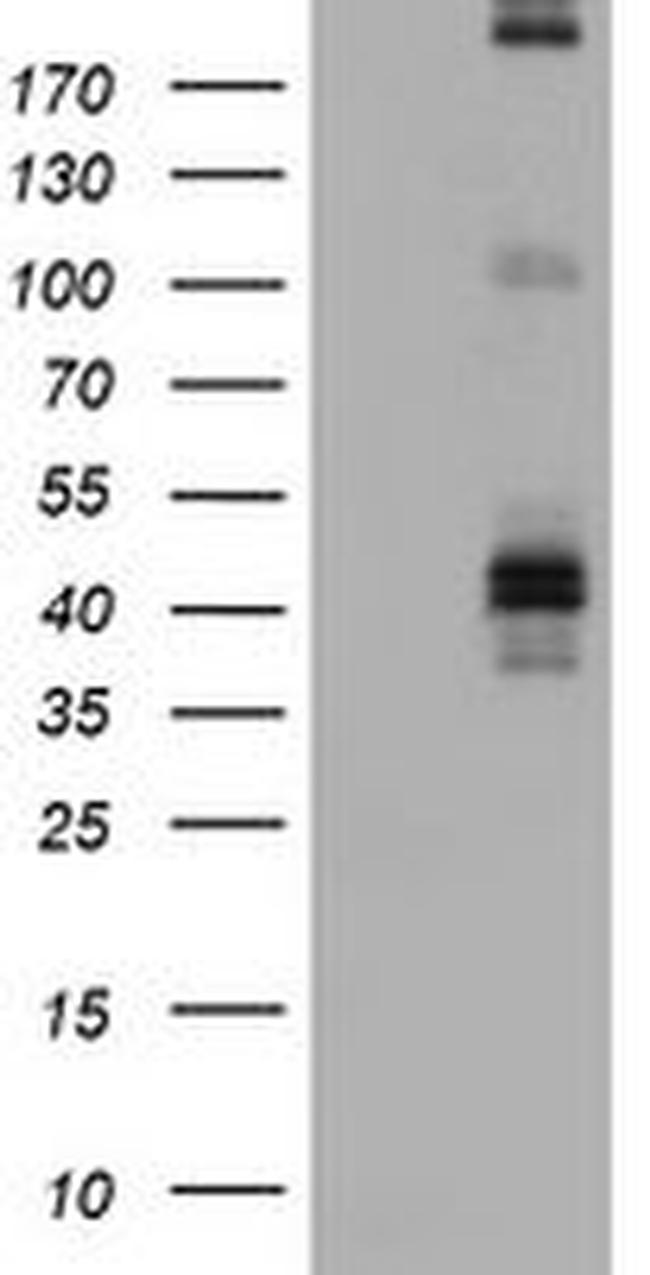 FCER2 Antibody in Western Blot (WB)