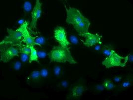 FCGR1A Antibody in Immunocytochemistry (ICC/IF)