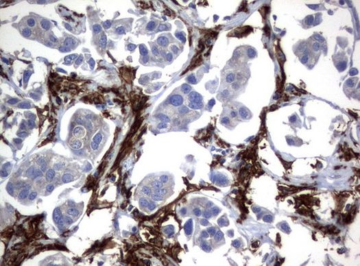 FCGR1A Antibody in Immunohistochemistry (Paraffin) (IHC (P))
