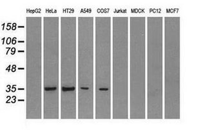 FCGR2A Antibody in Western Blot (WB)