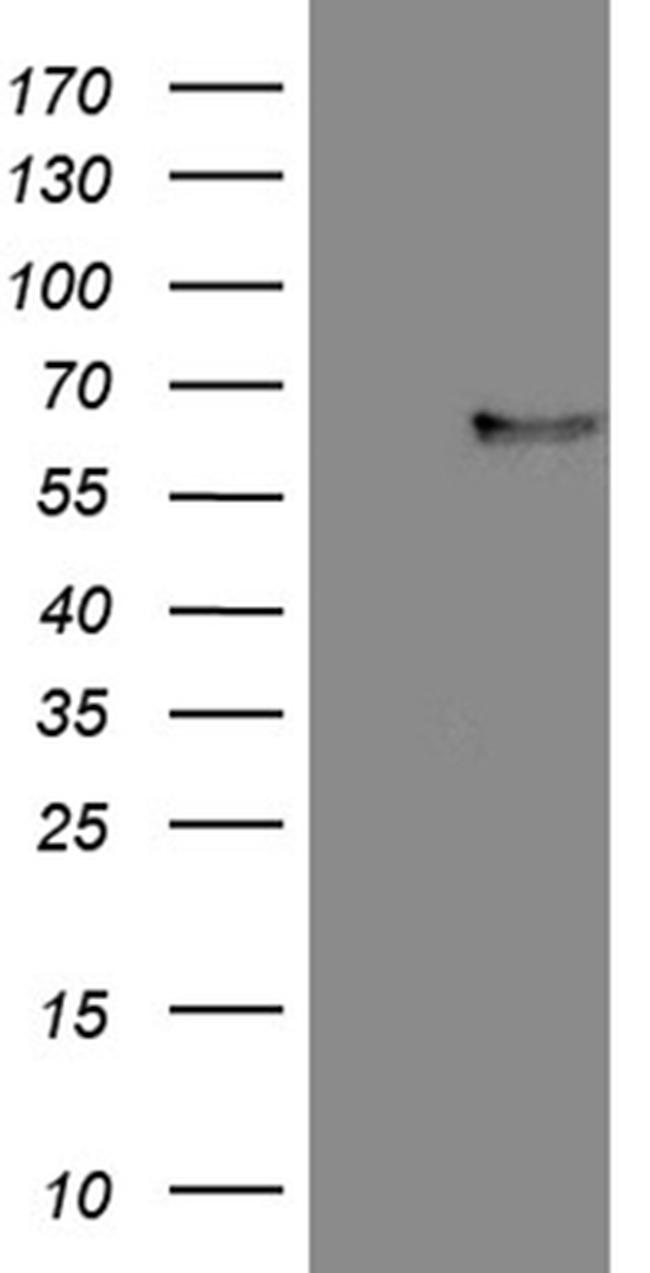 FCRLB Antibody in Western Blot (WB)