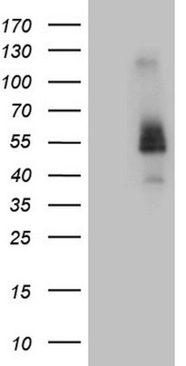 FCRLB Antibody in Western Blot (WB)