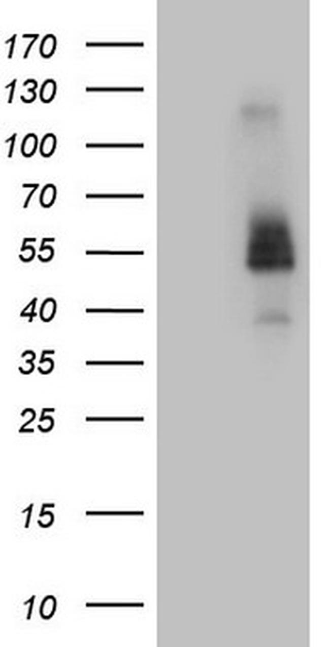 FCRLB Antibody in Western Blot (WB)