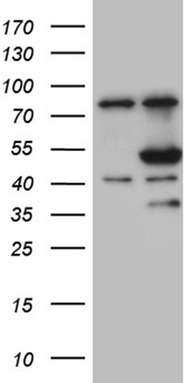 FCRLB Antibody in Western Blot (WB)