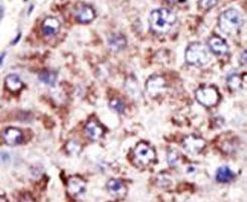 FDFT1 Antibody in Immunohistochemistry (IHC)