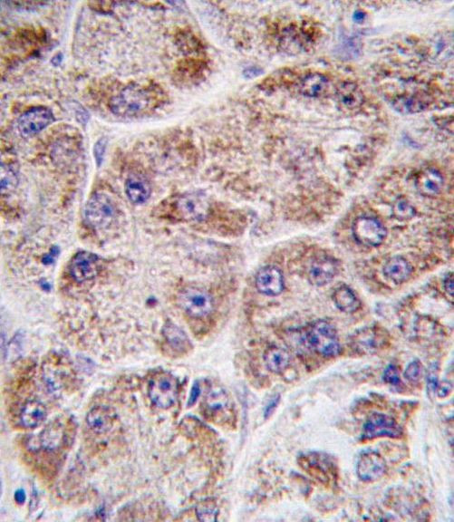 FDPS Antibody in Immunohistochemistry (IHC)