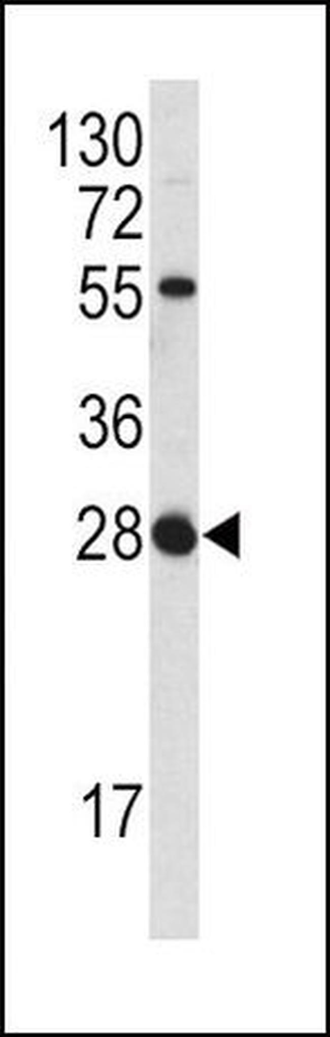 FGF18 Antibody in Western Blot (WB)