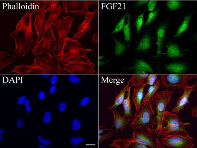 FGF21 Antibody in Immunocytochemistry (ICC/IF)