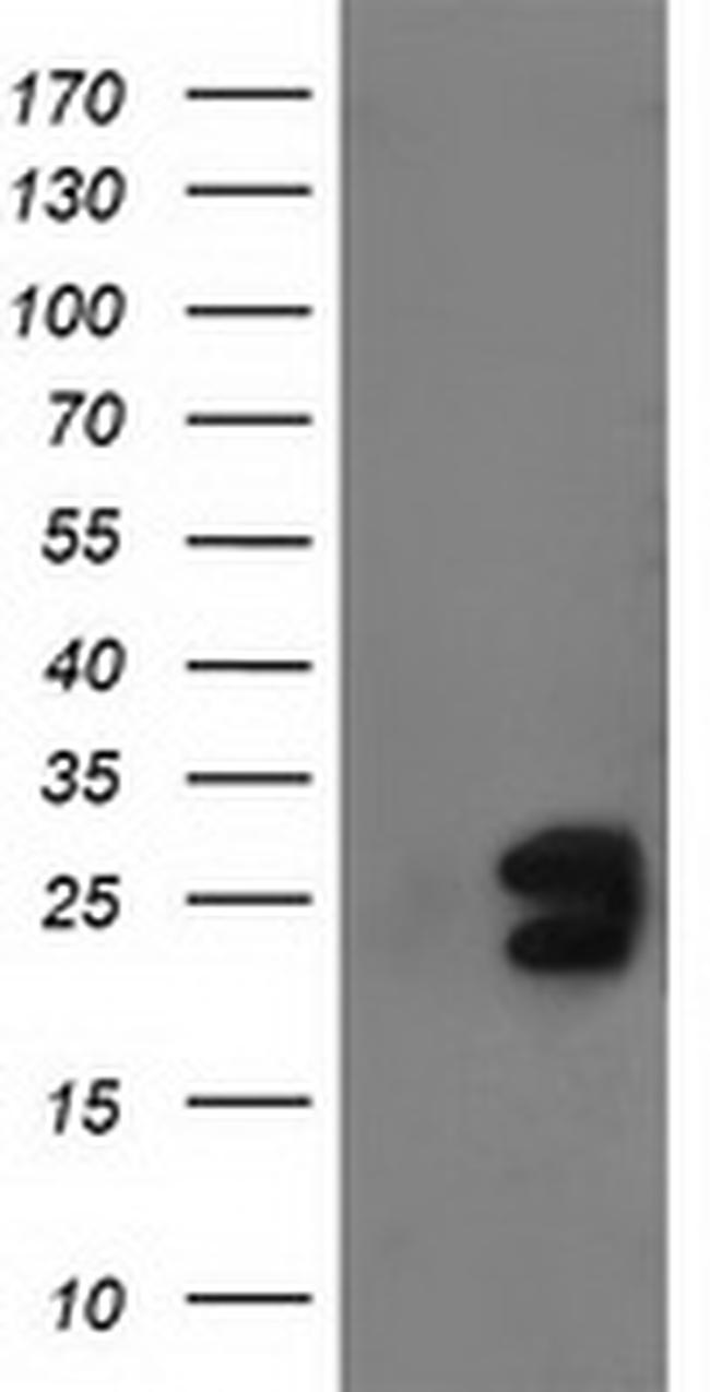 FGF21 Antibody in Western Blot (WB)
