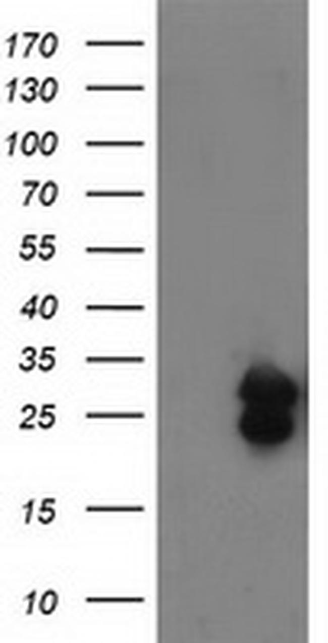 FGF21 Antibody in Western Blot (WB)