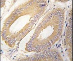 FGF4 Antibody in Immunohistochemistry (IHC)