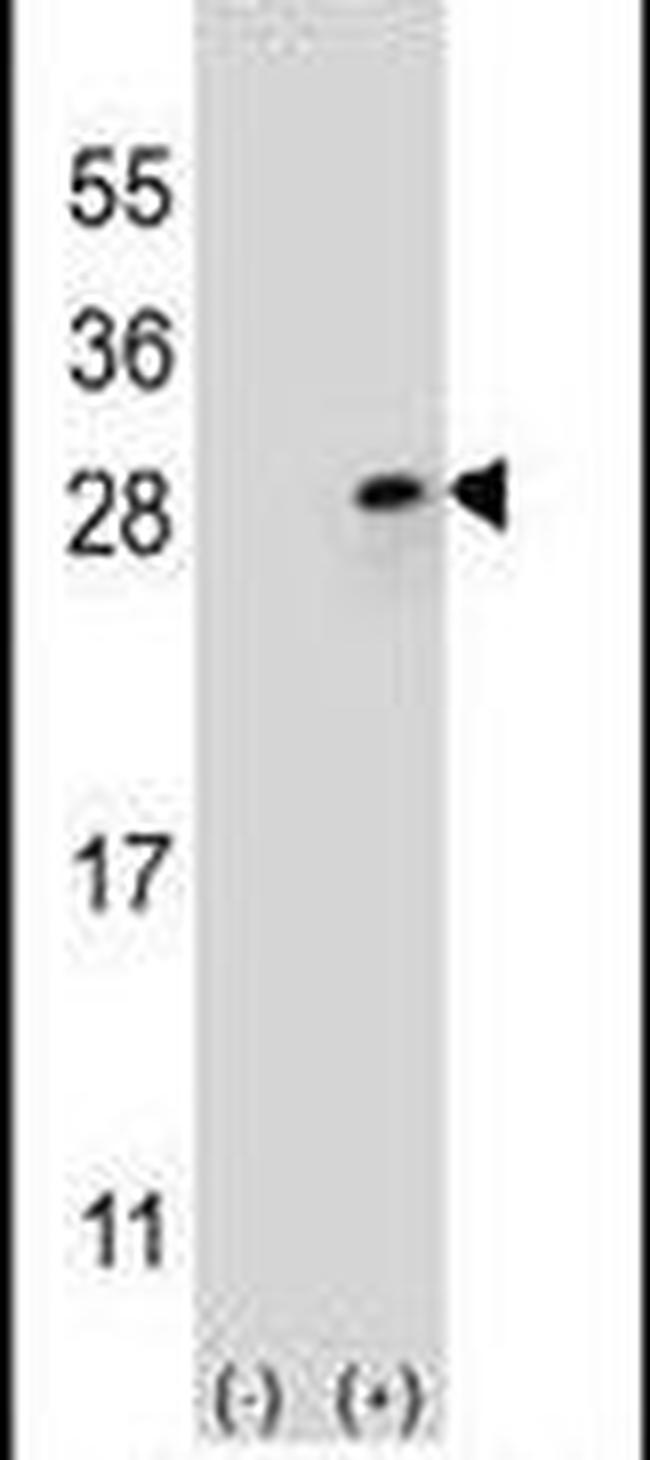 FGF9 Antibody in Western Blot (WB)