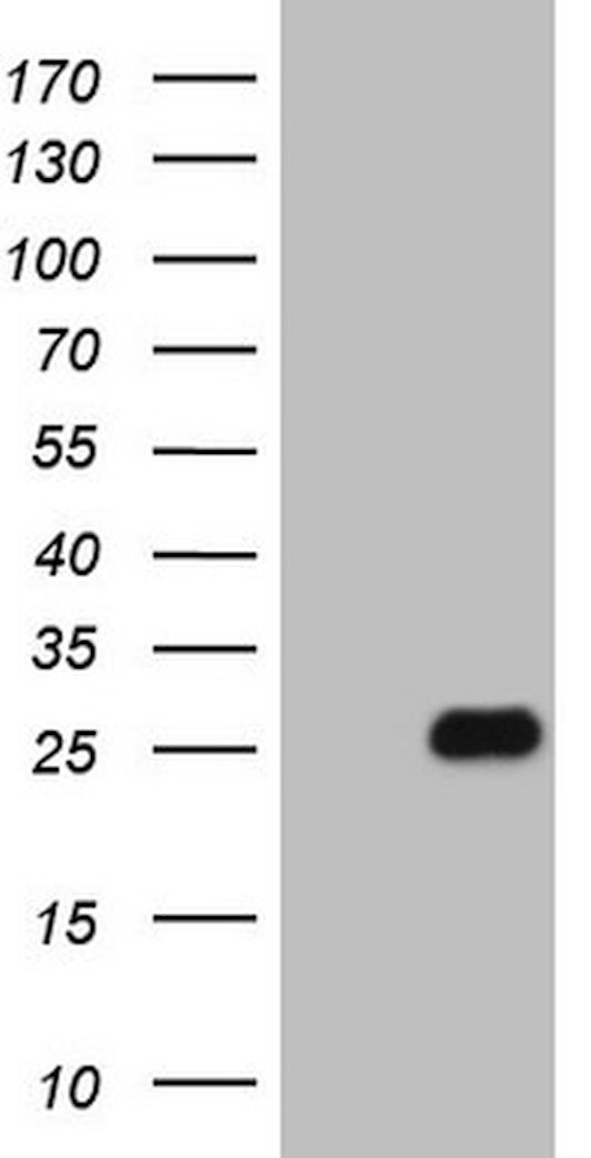 FGFBP1 Antibody in Western Blot (WB)