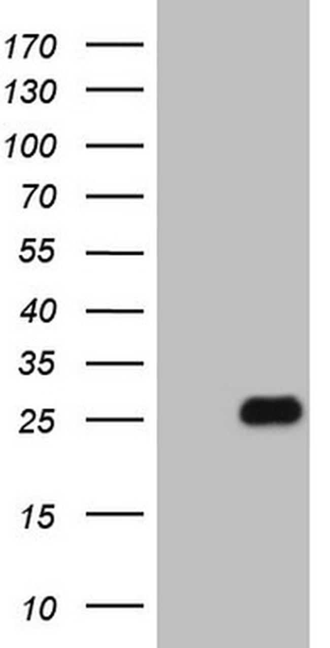 FGFBP1 Antibody in Western Blot (WB)