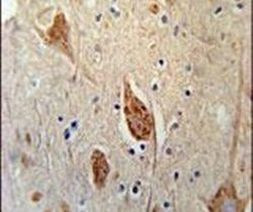 FGFBP3 Antibody in Immunohistochemistry (IHC)