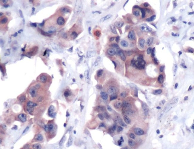 FGFR2 Antibody in Immunohistochemistry (IHC)