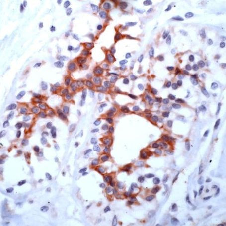 FGFR3 Antibody in Immunohistochemistry (IHC)