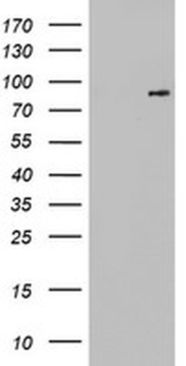 FGFR1 Antibody in Western Blot (WB)