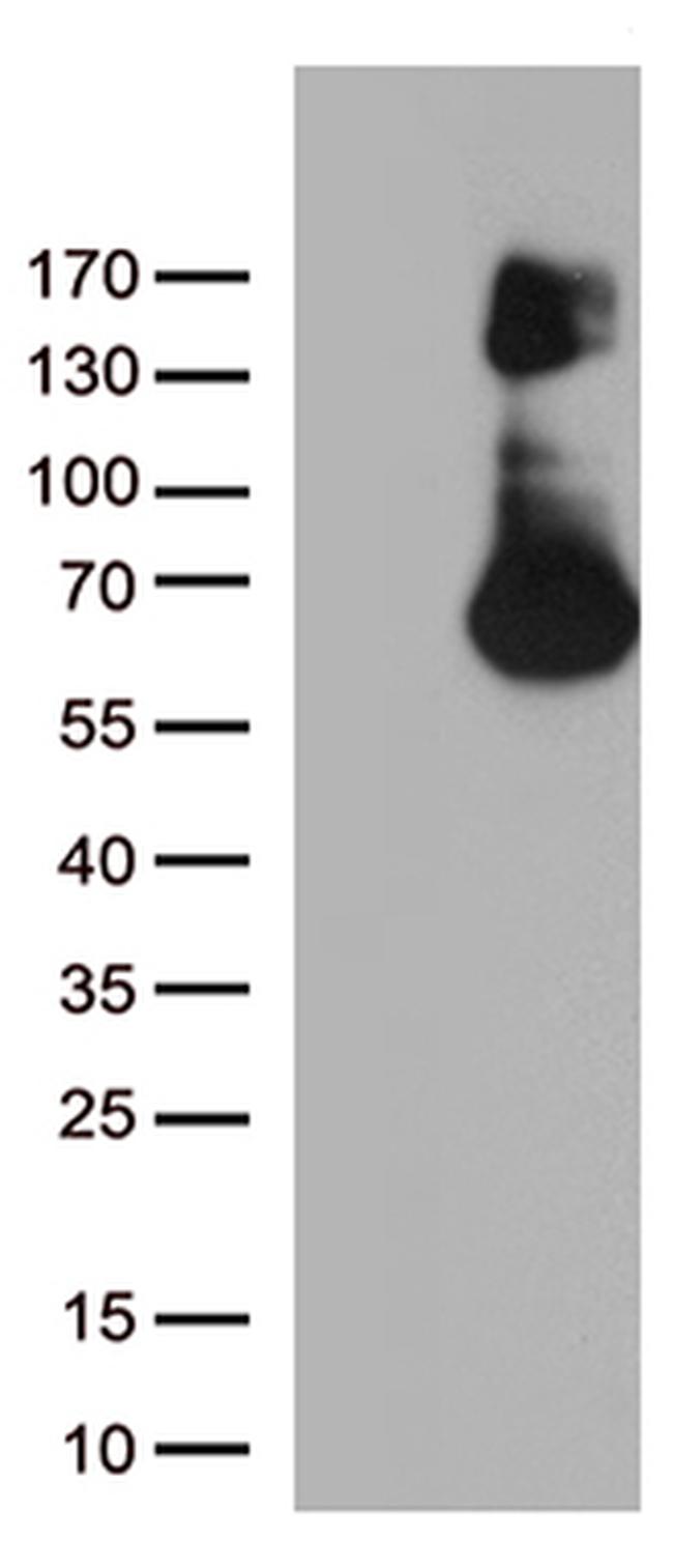 FGFR1 Antibody in Western Blot (WB)