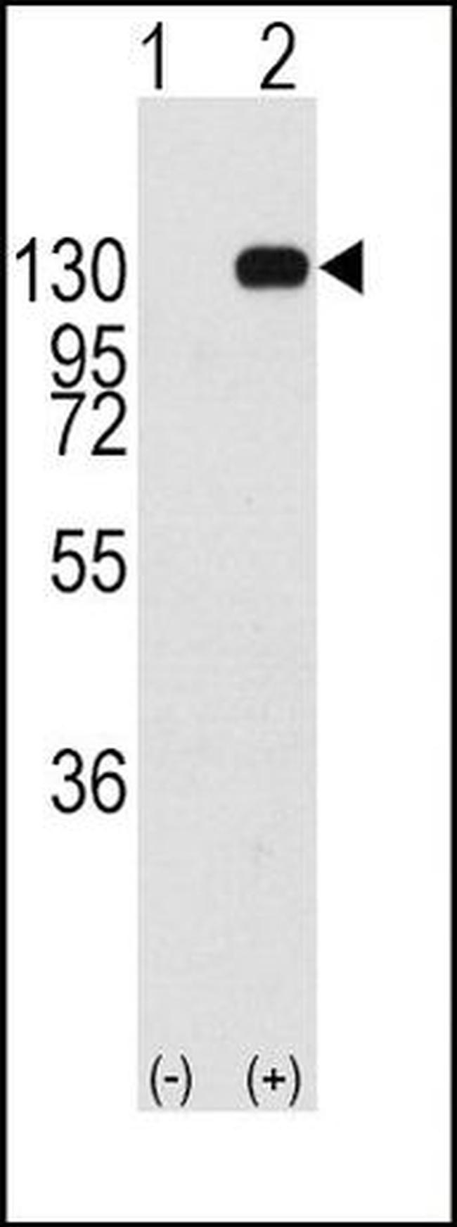 FGFR1 Antibody in Western Blot (WB)