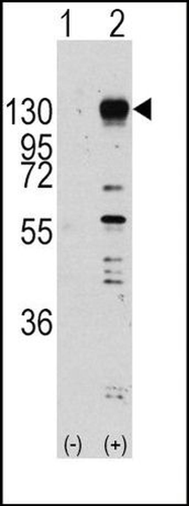 FGFR1 Antibody in Western Blot (WB)