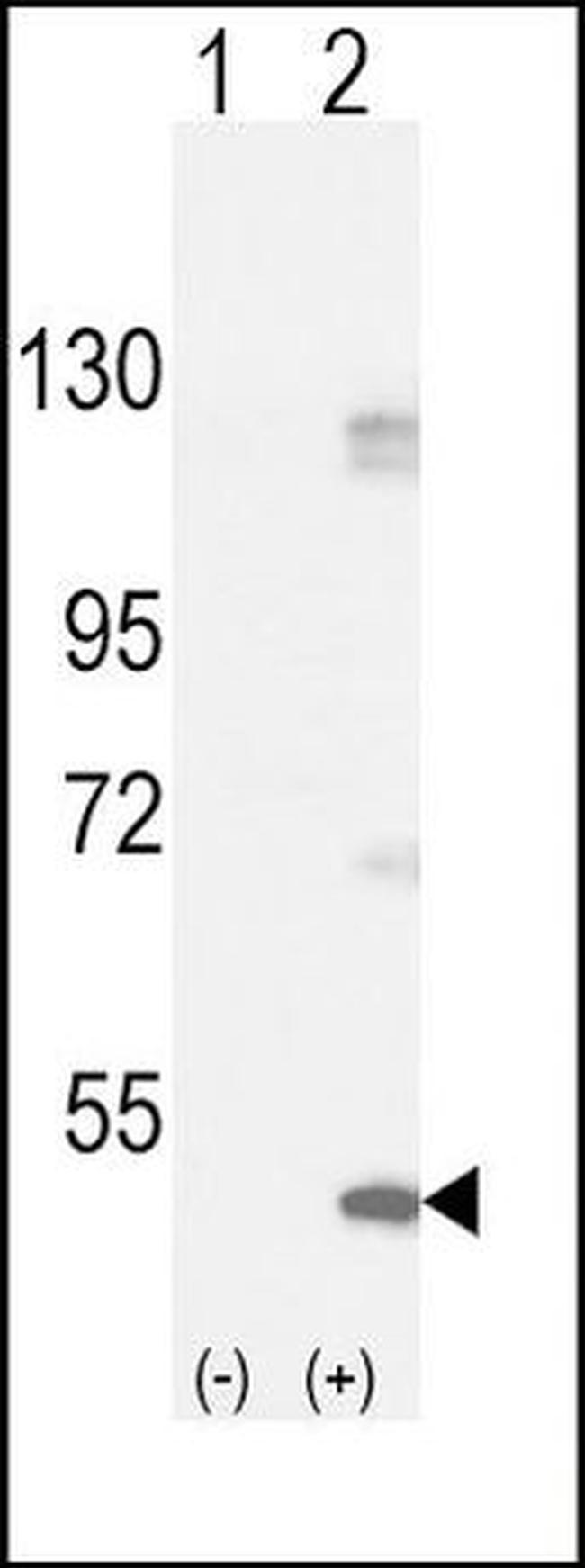 FGFR1 Antibody in Western Blot (WB)