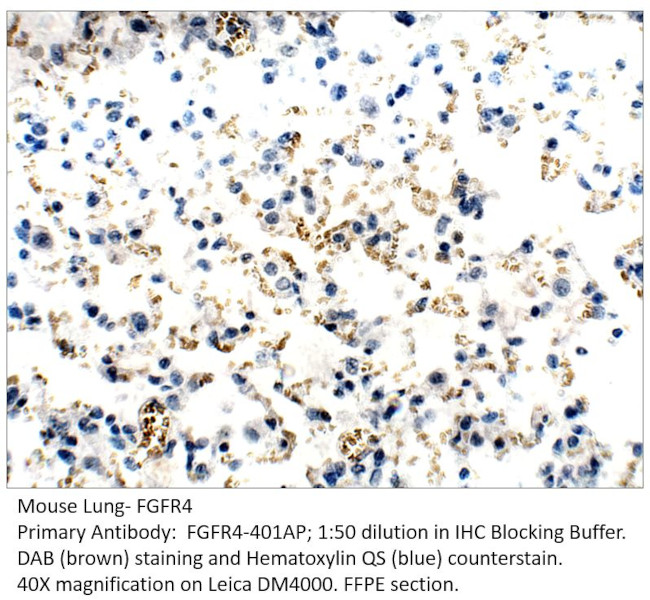 FGFR4 Antibody in Immunohistochemistry (IHC)