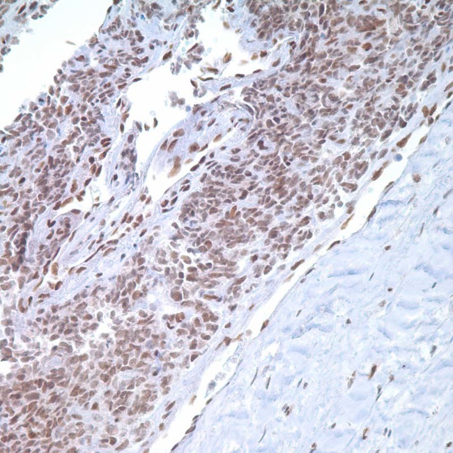 FGG Antibody in Immunohistochemistry (IHC)