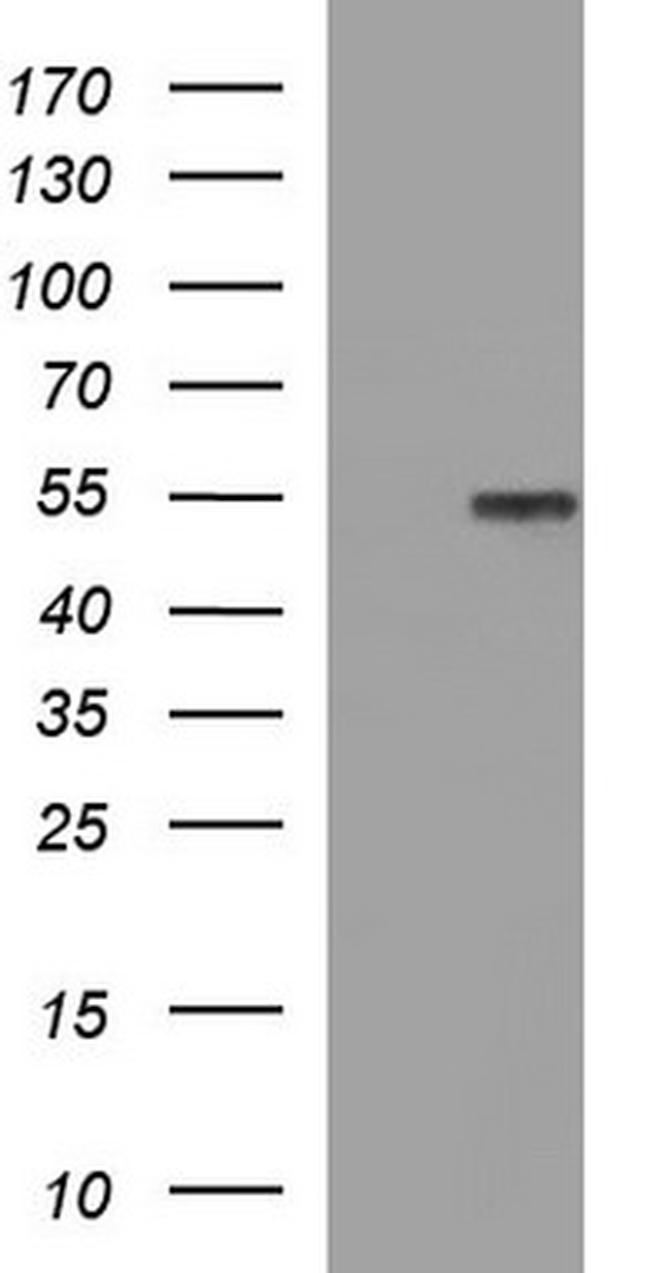 FGG Antibody in Western Blot (WB)