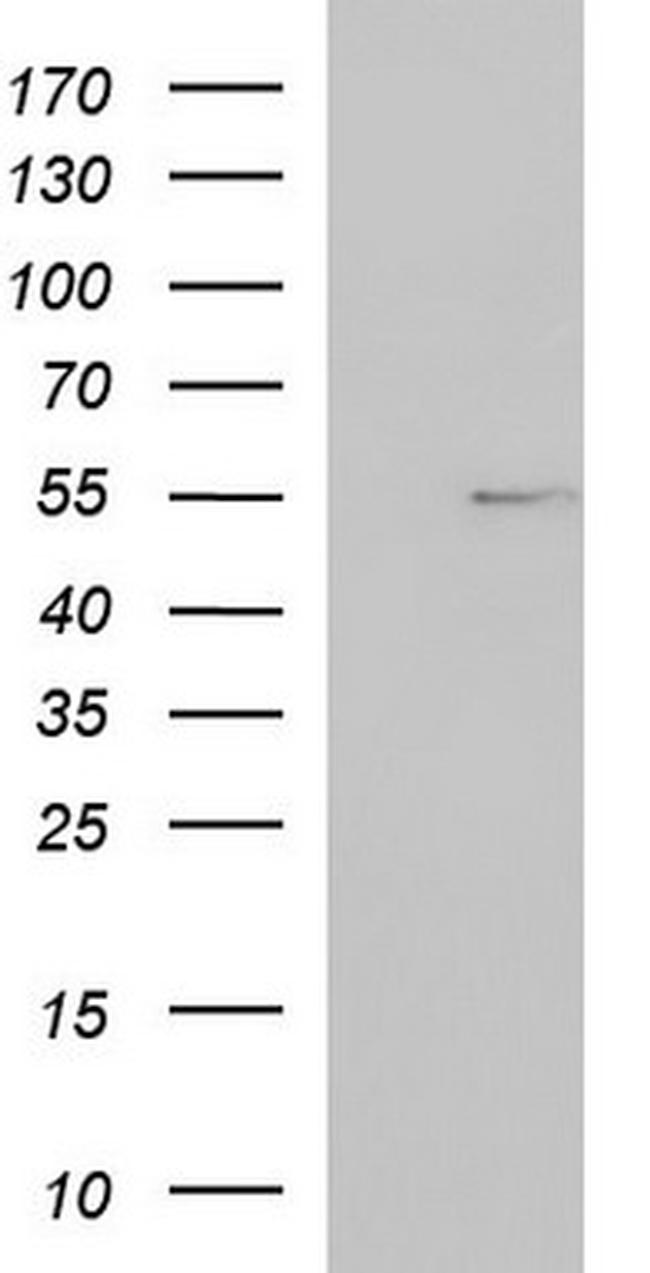FGG Antibody in Western Blot (WB)