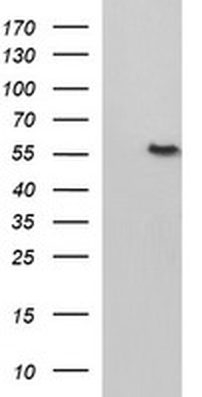 FGG Antibody in Western Blot (WB)