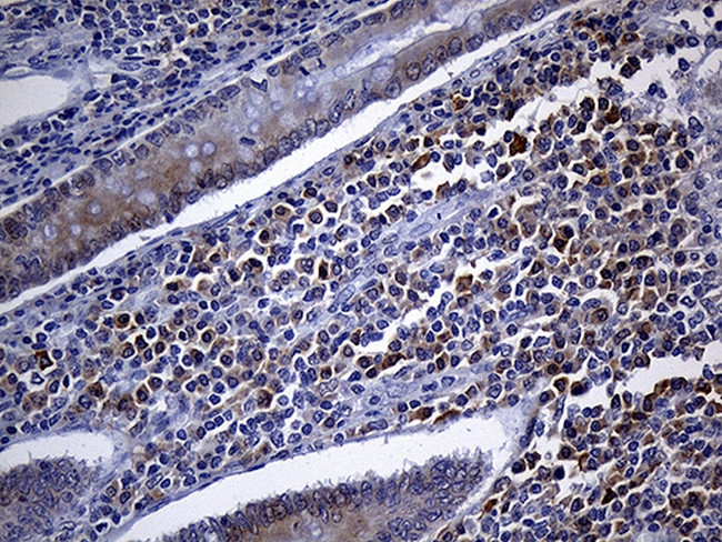 FHIT Antibody in Immunohistochemistry (Paraffin) (IHC (P))