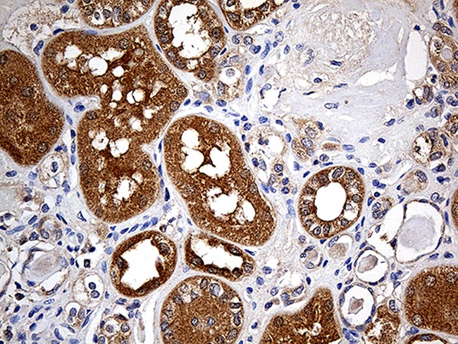 FHIT Antibody in Immunohistochemistry (Paraffin) (IHC (P))