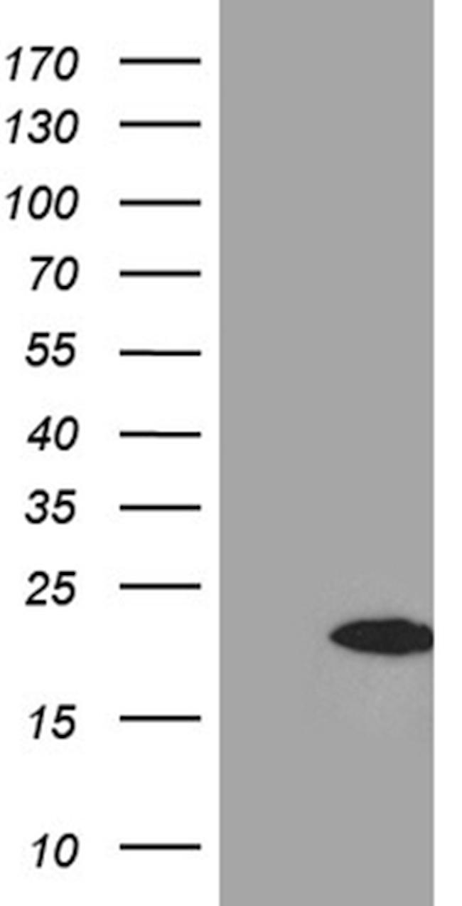 FHIT Antibody in Western Blot (WB)