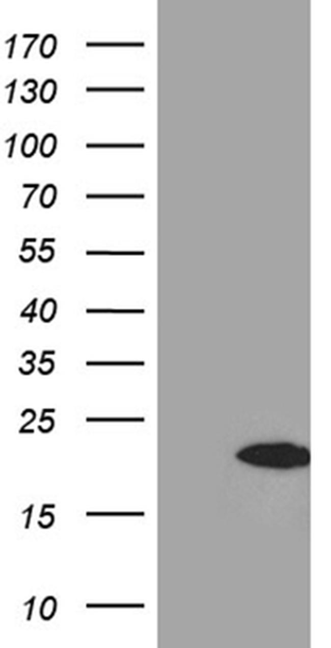 FHIT Antibody in Western Blot (WB)