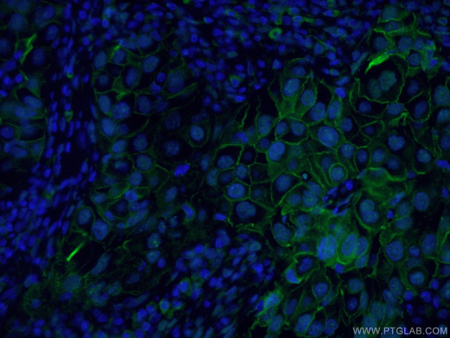 ICAM-1 Antibody in Immunohistochemistry (PFA fixed) (IHC (PFA))